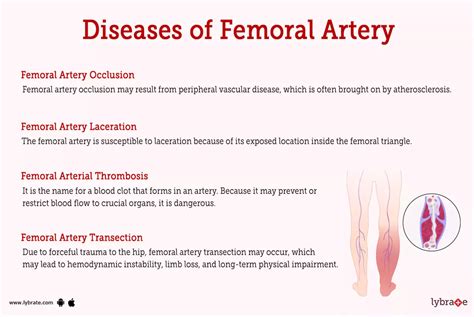 blood clot in femoral artery.
